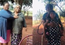 Muere en Brasil una mujer que tenía un «bebé de piedra» en su interior